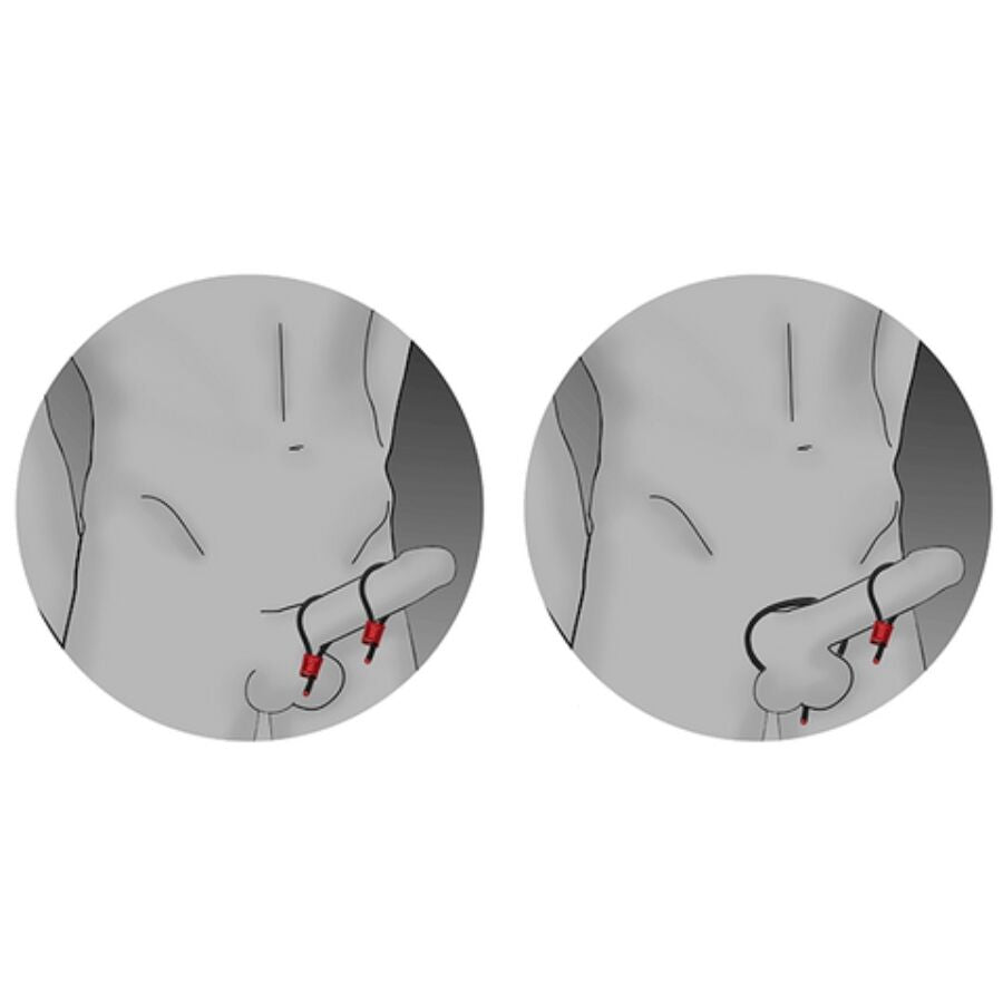 ELECTRASTIM - PRESTIGE ELECTRA LOOPS JUSTERBARE KUKRINGER RØDE
